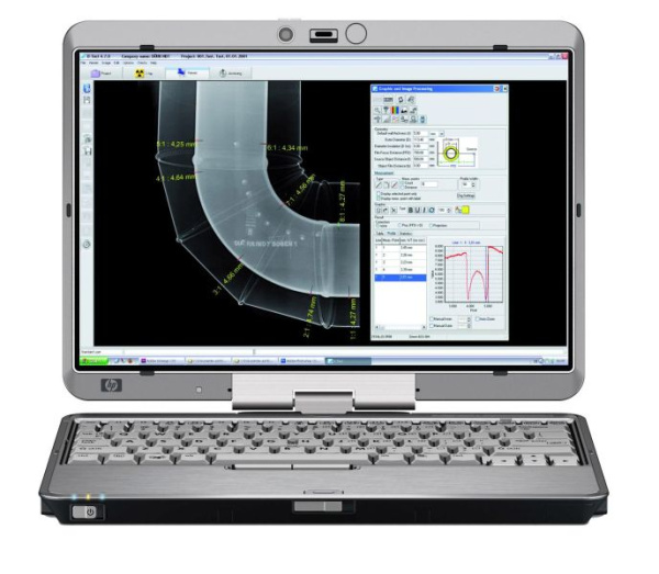 Комплекс цифровой радиографии «Градиент»